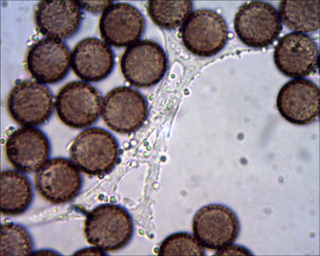 Badhamia or Physarum?
